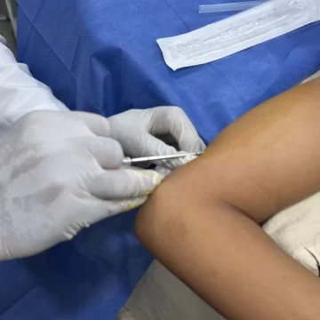 Realizará SSO jornadas gratuitas de implantes subdérmicos en el Istmo de Tehuantepec